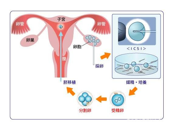 婴儿