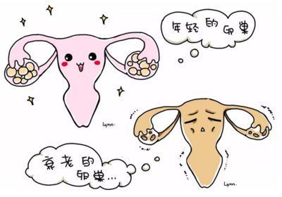 多囊卵巢综合症