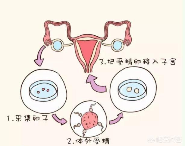 外国人家里分娩