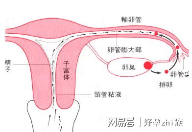 多囊卵巢综合征