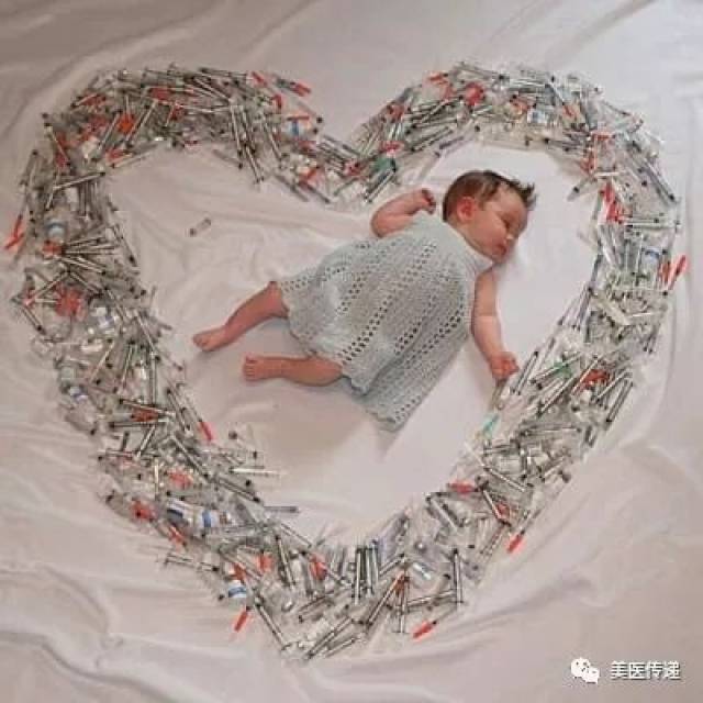 女性结扎